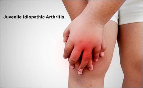 Ayurvedic Treatment For Juvenile Idiopathic Arthritis