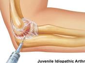 Ayurvedic Treatment Juvenile Idiopathic Arthritis