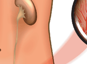 Ayurvedic Treatment Overactive Bladder