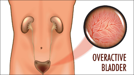Ayurvedic Treatment For Overactive Bladder