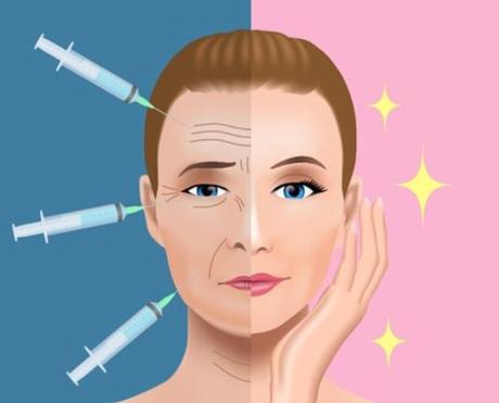 BOTOX Injection: Treatment for wrinkles & Anti-aging botox treatment and benefits
