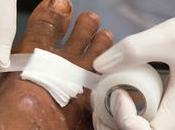 Wound Dressing Market Global Analysis Forecast 2025