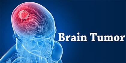 Brain Tumor And Its Ayurvedic Management With Remedies