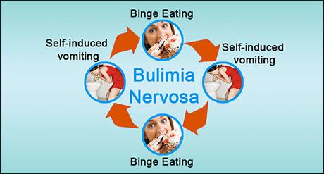 Everything You Need To Know About Bulimia Nervosa or Bulimia