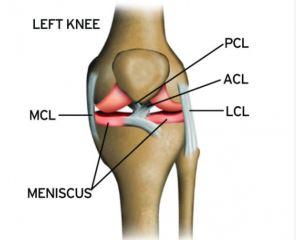 ACL Tear Treatment Without Surgery: Our New Publication!