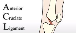 ACL Tear Treatment Without Surgery: Our New Publication!