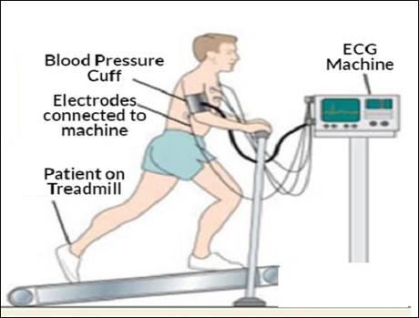 About ECG and TMT test & How can Ayurveda help you heal your heart