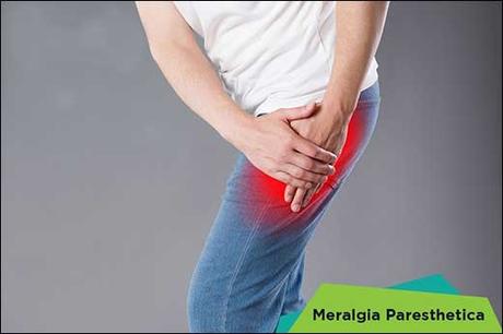 Natural Cure Of Meralgia Paresthetica