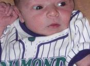 Comprehensive Explanations Caput Succedaneum That Paramount