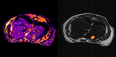 Small animal imaging is a technique for capturing images of biological processes in small animals.