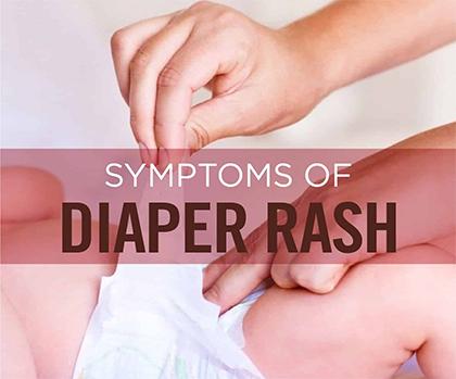 Ayurvedic View On Diaper Rash With Herbal Remedies