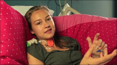 What is Myasthenia gravis?- Causes Symptoms and Ayurvedic Treatment