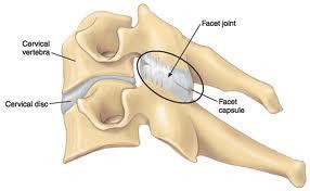 Pain in Left Side of Neck: Causes and Treatment Options