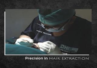 What to expect from the best hair transplant clinic in Lucknow?