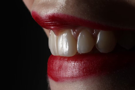 6 Tips And Tricks To Get Pearly White Teeth