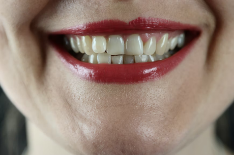 6 Tips And Tricks To Get Pearly White Teeth