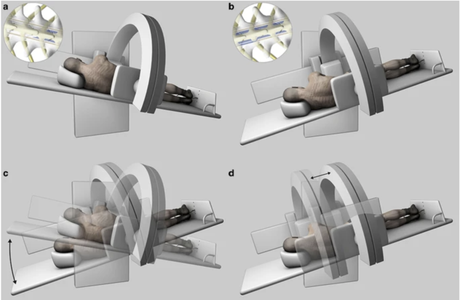 traditional digital subtraction myelogram