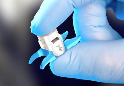 Interspinous Spacers Market The interspinous spacer Interspinous spacers, also known as interspinous process decompression systems, are small grafts used to relieve the painful symptoms of spinal stenosis caused by a spinal canal contraction.