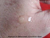 Treatment Products – Pimples!
