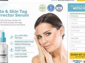 Eelhoe Skin Remover Review Instructions