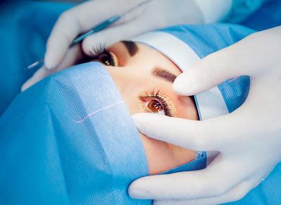 Ocular Surgery Market Ocular surgery, also known as eye surgery, is surgery performed on the eye or its adnexa by an ophthalmologist.