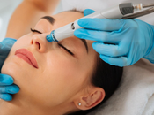 HydraFacial- Essential Things Need Know About This Skin Treatment