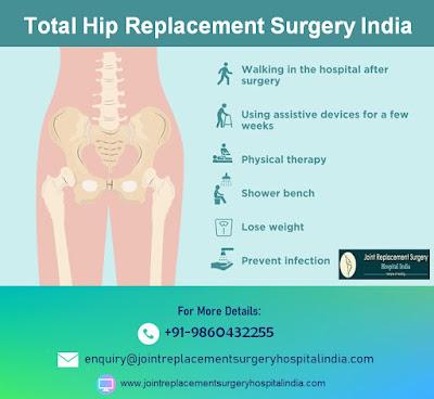 Total Hip Replacement Surgery India