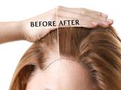 Women Regrow Thinning Hair?