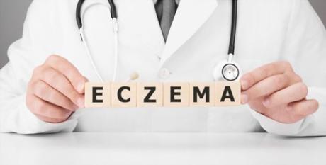 Eczema Types & Treatments