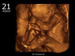 21_week_ultrasound_3d