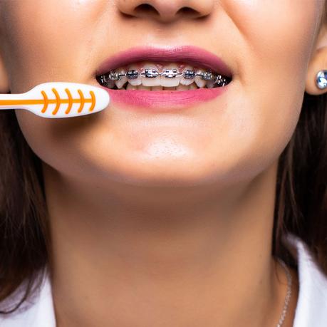 toothbrushes for braces