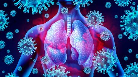 Long COVID-19 and other chronic respiratory conditions after viral infections may stem from an overactive immune response in the lungs