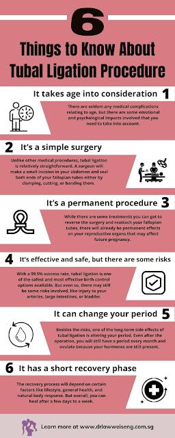 6 Thing to Know About Tubal Ligation Procedure