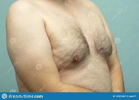 I Don’t Want To Spend ANYWHERE NEAR THIS MUCH Time On How To Get Rid Of Back Boobs. How About You? I Don’t Want To Spend ANYWHERE NEAR THIS MUCH Time On How To Get Rid Of Back Boobs. How About You?