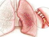 Eosinophilic Lung Disease/Pulmonary Eosinophilia Ayurvedic Aspect