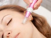Much Does Microneedling Cost? Know Here!