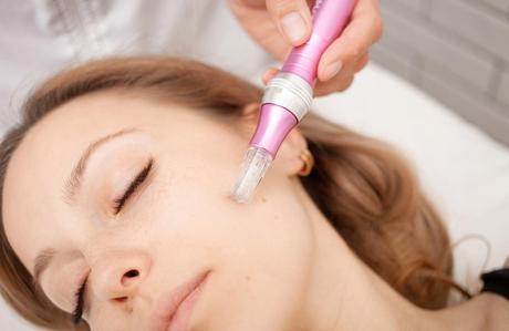 How Much Does Microneedling Cost? Know it All Here!