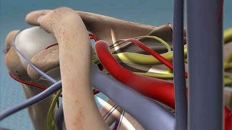 Thoracic Outlet Syndrome