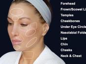 Everything About JUVÉDERM® Dermal Fillers Venice Florida