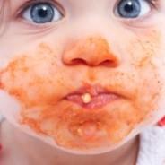 Overview of the Common Food Allergies in Children