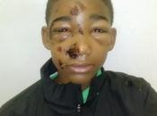 14yr Severely Tazed Beaten Police