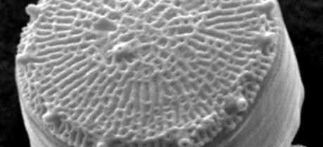 A scanning electron microscope image of the diatom Thalassiosira pseudonana.