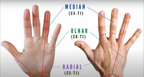 How to Fix a Pinched Nerve in the Neck