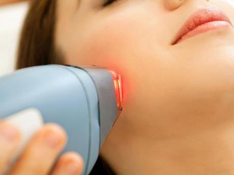 Types of Cosmetic Laser Procedures