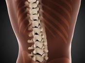 Lordosis (Swayback), Symptoms Treatment