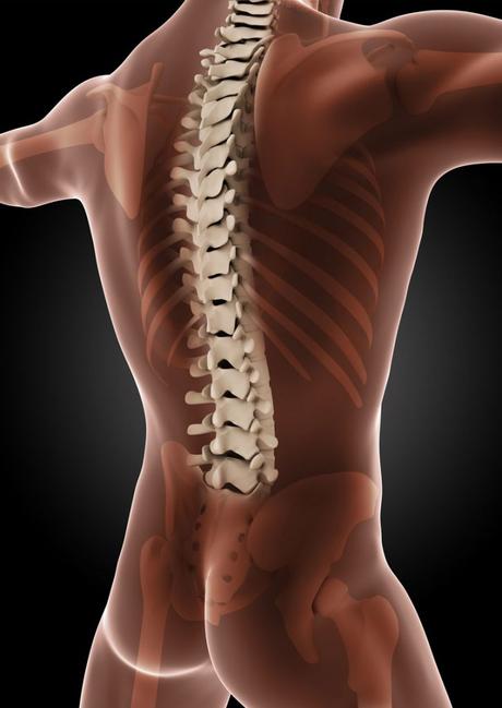 Lordosis (Swayback)