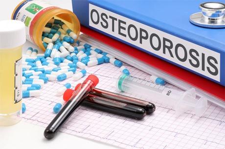 How to prevent Osteoporosis? Find out how you can keep your bones in top condition and ensure good health at every age with these diet, exercise & lifestyle tips.
