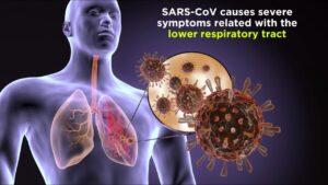 Coronavirus definition and examples