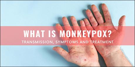 Monkeypox – A Disease Spreading Among Humans or Animals?