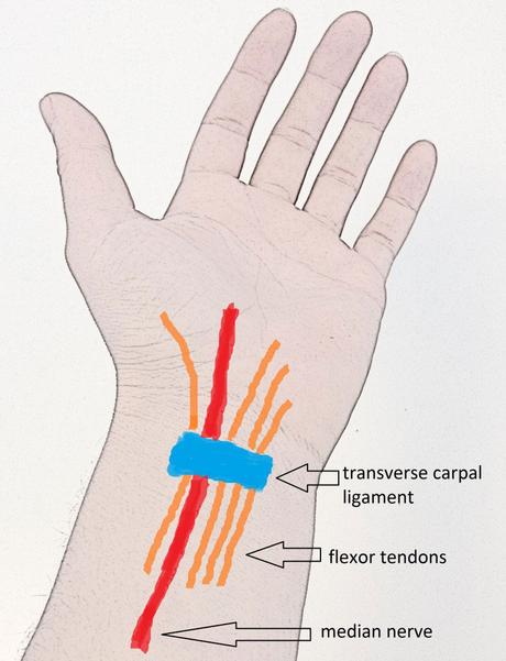 Carpal tunnel